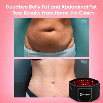 LifePro Alleva - Red Light Therapy Belt